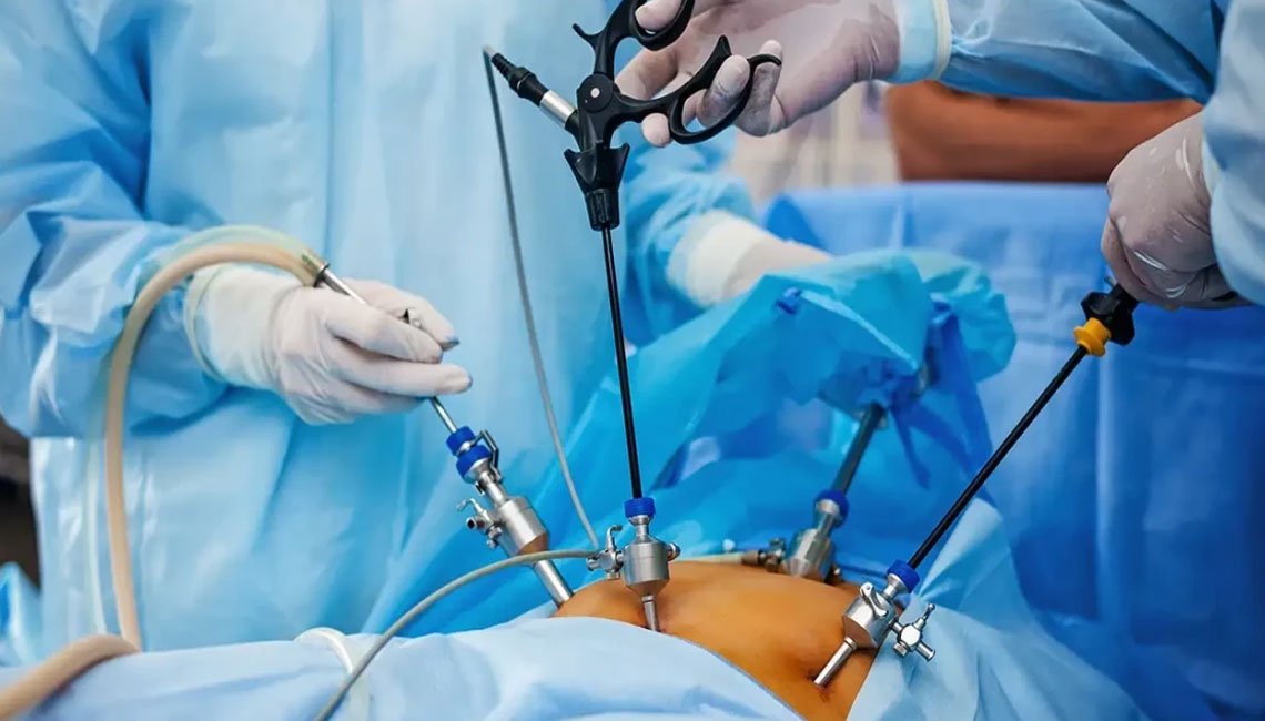 Laparoscopic  Surgery